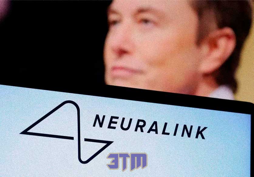 Первый имплантат человеческого мозга Neuralink столкнулся с частичной неисправностью 2 Neuralink